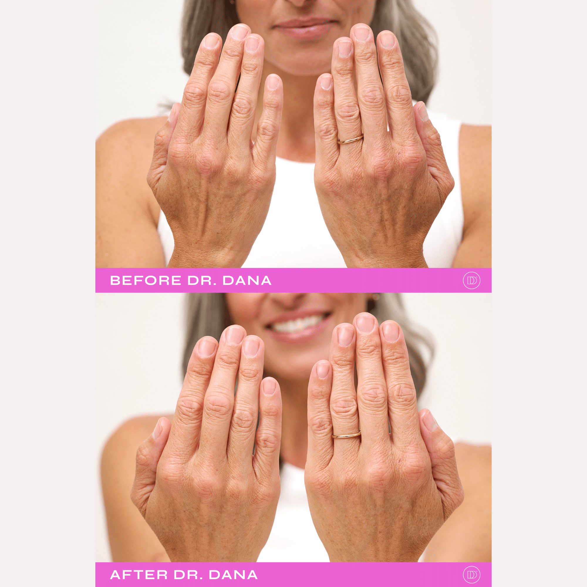 Dr. Dana Nail Renewal System